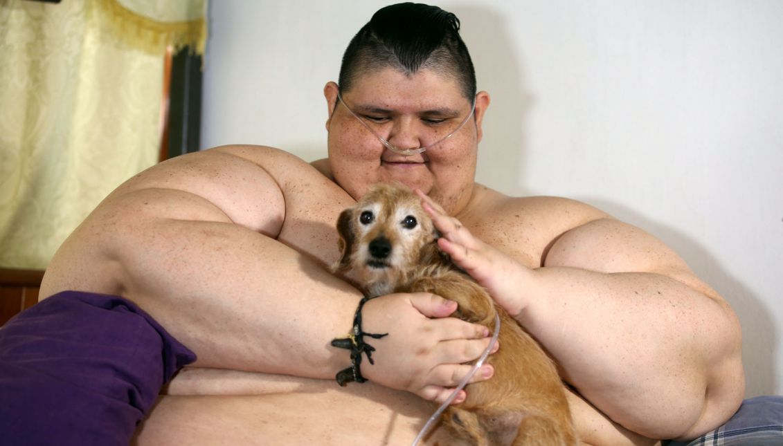 Mexican Juan Pedro Franco, the most obese man in the world at 500 kgs, delivers a press conference to announce the treatment he will undergo in order to lose 10 percent of his body-mass, in Guadalajara, Jalisco, Mexico, 21 December 2016. EPA/Ulises Ruiz Basurto
