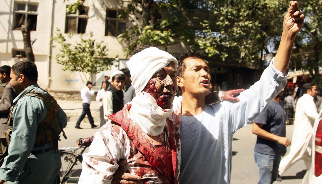 A man who was injured in a suicide bomb attack, reacts at the scene, in Kabul, Afghanistan, May 31, 2017. EPA/JAWAD JALALI
