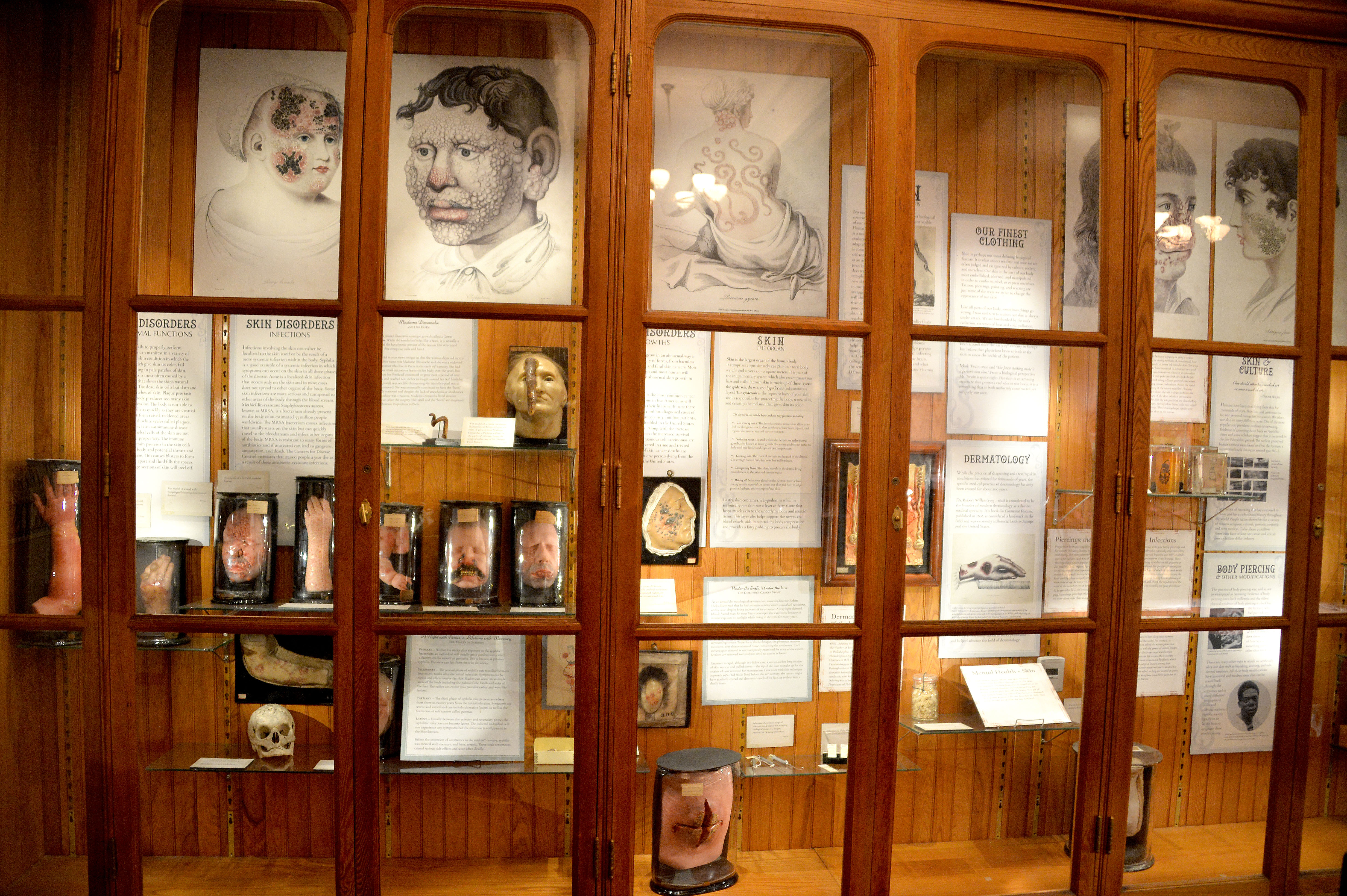 A display on the human skin and how ailments effect it are one of the many oddities you will see at the Mutter Museum. Photo: Peter Fitzpatrick/AL DIA News