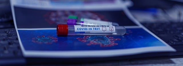 prueba de sangre para covid